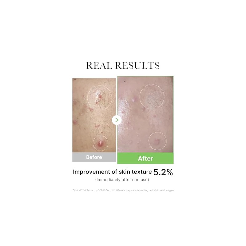 MEDICUBE Exosome Cica Ampoule serum calmante para rostro con Centella