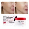Crema Aclarante Ácido Kójico, Manchas Paño, Sol, Acné, 50g