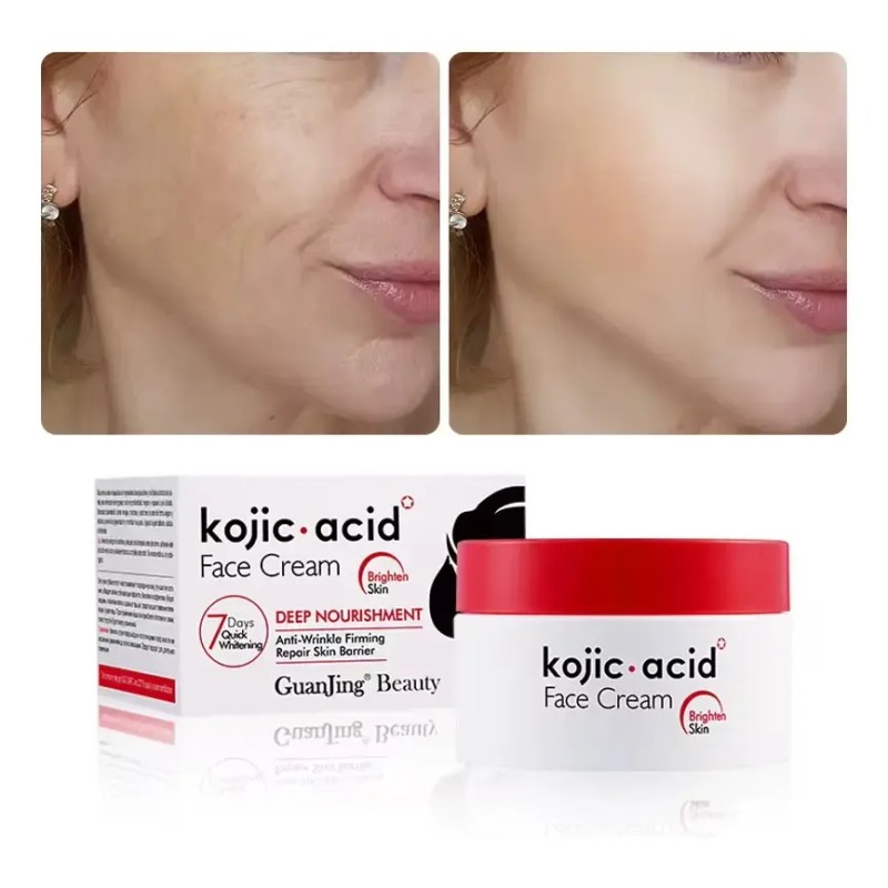 Crema Aclarante Ácido Kójico, Manchas Paño, Sol, Acné, 50g