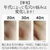 [Japanese Eye cream] Dr.Ci:Labo VC100 All - in - One