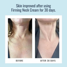 Foundation Skincare Crema Reafirmante Para El Cuello: Reafirma, Fortalece E Hidrata La Piel Arrugada Para Un Cuello Y Escote De Aspecto Más Juvenil. Con Péptidos Y Agentes Hidratantes Naturales. 2 Oz.