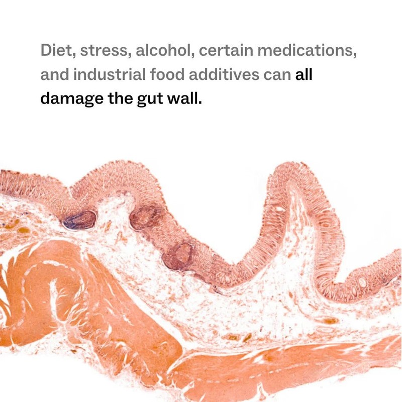 My Way Up Complete Gut Repair System Bundle