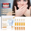 14 Piezas Gel De Cuidado Gingival 1.5ml