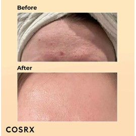 Cosrx Esencia Tonico Advanced Snail Baba De Caracol 96 100ml