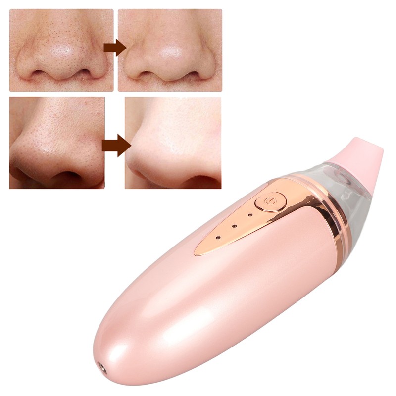 Silicone Blackhead Remover 3 Suction Levels 3 Replacement Tips USB