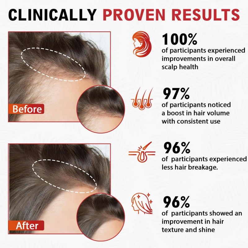 Tratatiempo / Champú Batana 18 Ingredientes Naturales 500 Ml