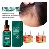 Aceite De Foliculitis Del Cuero Cabelludo, Natural Y Nutriti