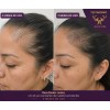 1 Shampoo Anticaída Y Crecimiento Chile Y Romero Vital Root