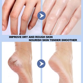 RTQSU Crack Feet Prevention Stick, Anti Crack Foot Cream Stick, Foot Care Cream Cracked Feet, Moisturizing Foot Balm, Softening and Nourishing Cream for For Dry Heels