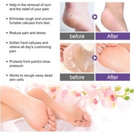 2 Pares Mascarilla Exfoliante Para Pies que Deja Los Pies Suaves Como Los de un Bebé, Para Pieles Agrietadas y Secas, Callos y Piel Muerta, Mascarilla de Lavanda Para Pies
