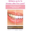 Novashine Professional Teeth Whitening Kit: Advanced Blue LED Light, Concentrated