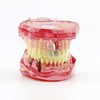 Global-Dental Removable Implant Studying Analysis Demonstration Teeth Model with Restoration