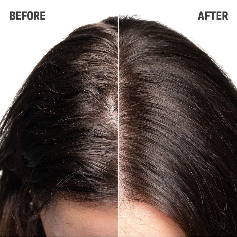 Goldwell Dualsenses Scalp Specialist Rebalance & Hydrate Fluid, For Sensitive
