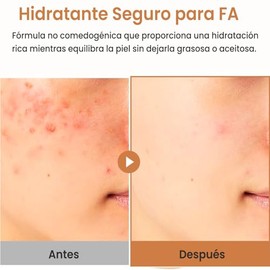 PURITO crema hidratante facial en gel con avena sativa 100 ml - gel hidratante facial para piel grasa y mixta - crema ligera calmante para rostro - sk