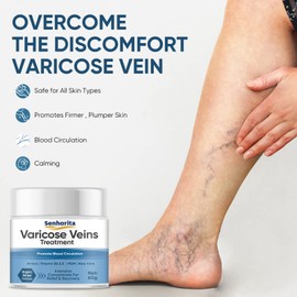 Varicose Veins Treatment for Legs, Varicose Veins Cream Improves Blood Circulation, Reduces Varicose Veins and Heaviness