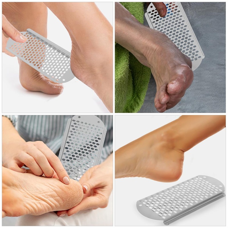 Mikinona Foot Skin File Rasp Callus Shaver Callus Remover for