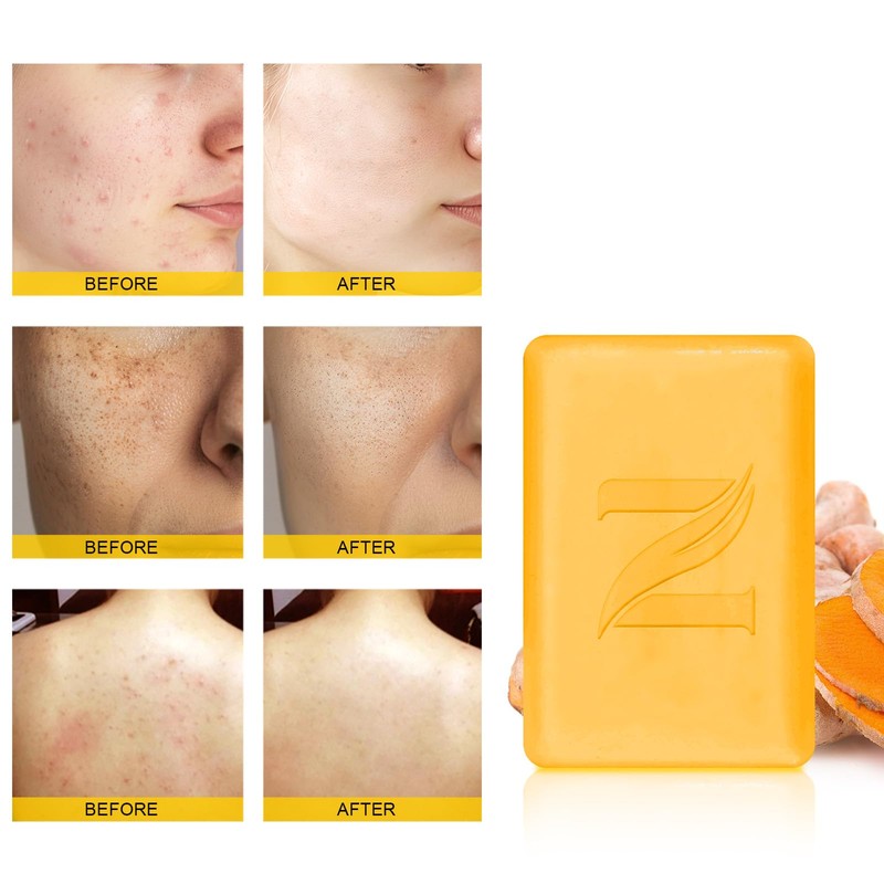 Neutriherbs Turmeric Soap for Face Body (5.29 oz.1 Bar), Brightening