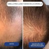 Péptidos de Cobre Cabello, Copper Peptide Serum, Mild Maintenance for