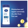 Vaseline Vaseline Expert Care Instant Dry Skin Rescue Body Lotion