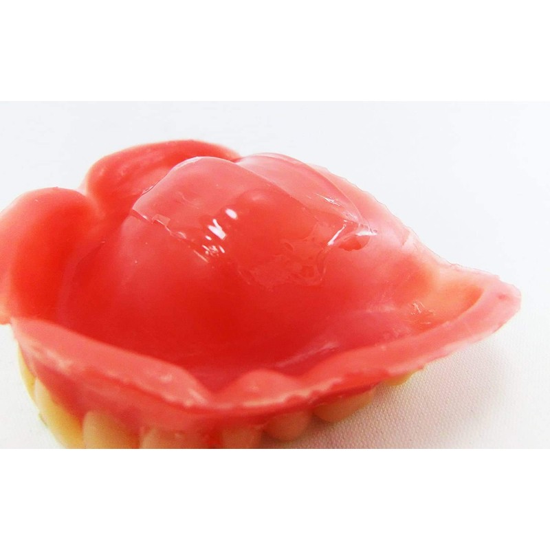 tahugurippukusshon Transparent, Dentures, Stabilizers (Total, Dentures, and part, Dentures,) G