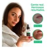 YEOUTH Acido Glicolico Peeling Facial para la Car, Exfoliante Químico