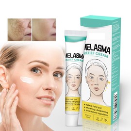 Mnozreo Creme für Sommersprossen, depigmentierende Creme für das Gesicht, Aufhellung bei Sommersprossen, Aufhellung für Sommersprossen, 20 g, 1 Stück