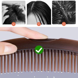 Flomiara 2 Pcs Dandruff Comb, Energy Massage Pressable Hair Comb Fine Hollow Tooth Tail Scalp Combs for Dandruff Removal & Promoting Hair Health for Women Men, Pressable Scalp Sweep Detoxing Combs