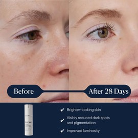 ELEMIS Dynamic Resurfacing Super-C Serum, Brightening Antioxidant Vitamin C Serum Refines & Illuminates, Combines Radiance Actives & Tri-Enzyme Technology to Leave Skin Looking Visibly Smoother, 30ml