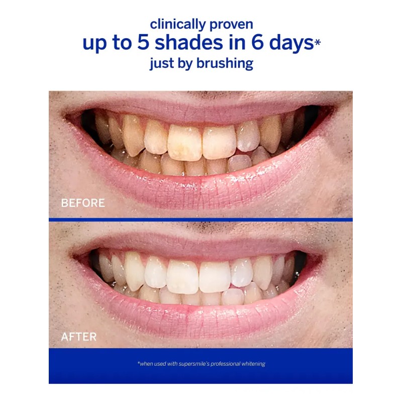 Pasta De Dientes Supersmile Professional Para Blanquear Los