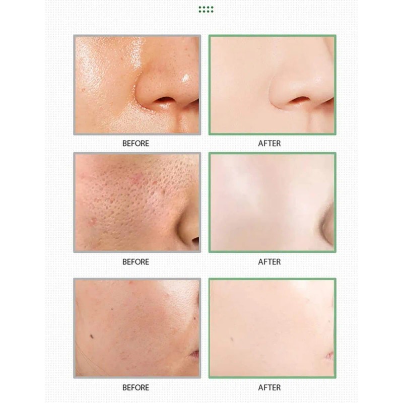 🔥 Mascarilla mask stick green tea anti acne limpieza profunda