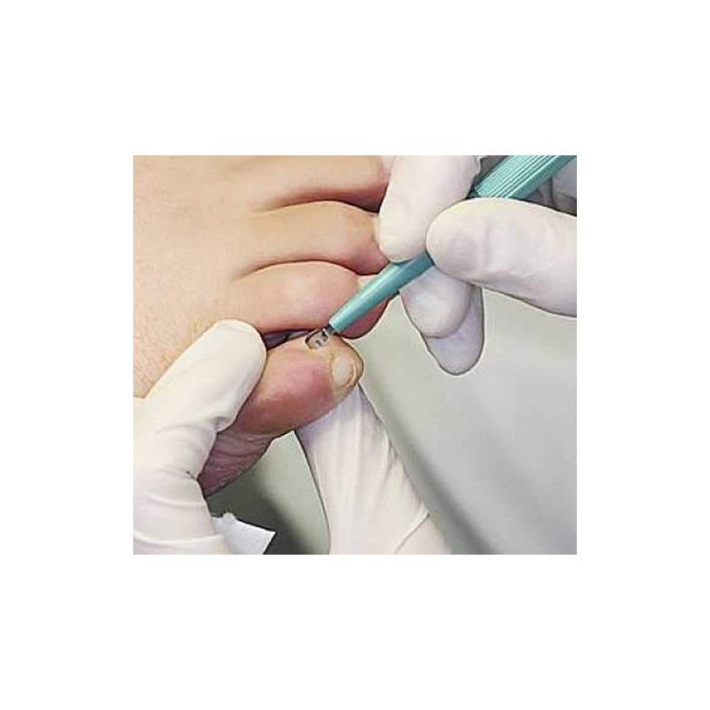 Skin curette, sharp Kai curette for curettage, Kosmetex skin curettes,