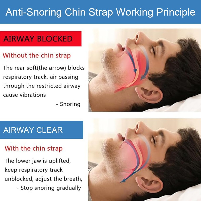 Anti Snoring Chin Strap, Update Snoring Stopper Snoring Solution Professional