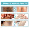 Eazerom Body Lotion 14