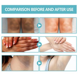 Eazerom Body Lotion 14