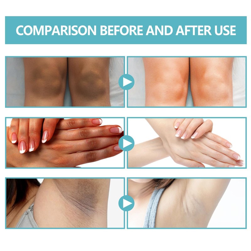 Eazerom Body Lotion 14