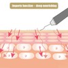 Household Ultrasonic Skin Scrubber Blackhead Removal Face Pore Cleanser InstrumentWhite