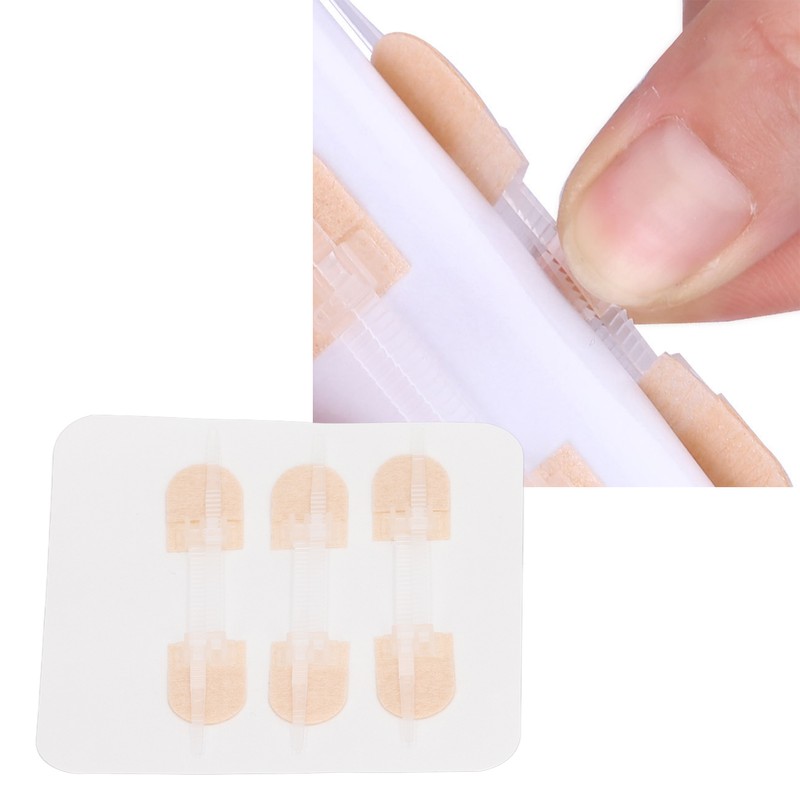 3 Strap Zipper Wound Closure Patches Breathable Seamless Elastic Zip