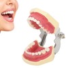 Periodontal Disease Teeth Resin Model Dental Demonstration Teeth Model for