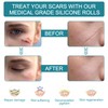 Medical Grade Silicone Scar Sheets, Silicone Scar Tape (1.6”x 60”),