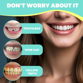 1 Pair Smile Teeth Veneers, Prostheses Fake Teeth, Comfort Instant Cosmetic Veneers Teeth Top and Bottom, False Artificial Temporary Braces, for Men and Women