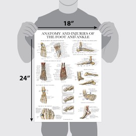 Laminated Anatomy and Injuries of the Foot and Ankle Poster - Anatomical Chart of Foot and Ankle Joint - 18" x 24"
