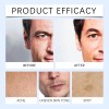 Nn Limpiador Facial Para Hombres: Fórmula Suave E Hidratante