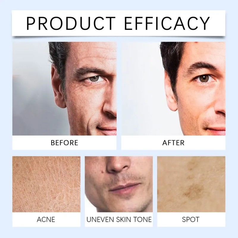Nn Limpiador Facial Para Hombres: Fórmula Suave E Hidratante