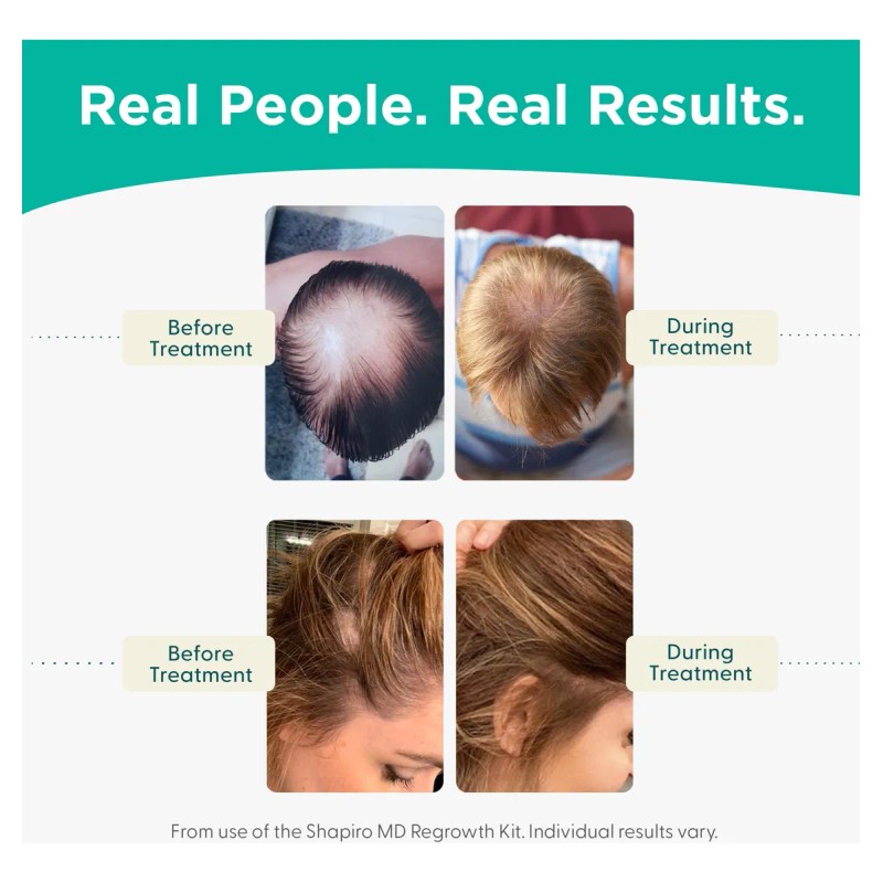 Set De Champú Y Acondicionador Shapiro Md Hair Loss 1