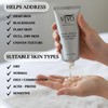 Vivo Per Lei Facial Peeling Gel - Helps Address Dead