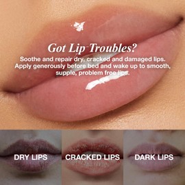 Lip Remedy Lip Balm 0.28oz Strawberry Scented Long-Lasting Hydration Repairs Dry Cracked Lips Overnight Moisturizing Formula (Strawberry)