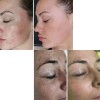 2 Pack Crema Facial Jabón Baba Caracol Sheló Nabel