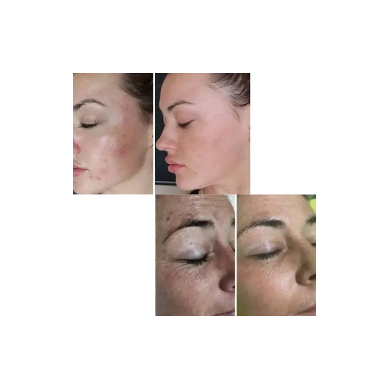 2 Pack Crema Facial Jabón Baba Caracol Sheló Nabel