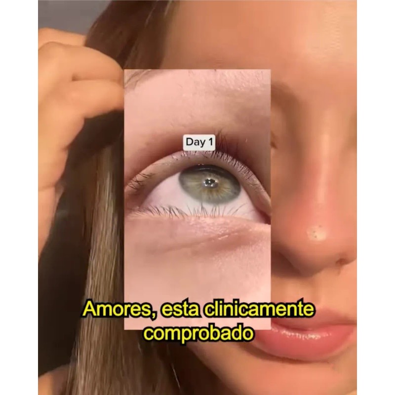 Versox Estimulador Crecimiento Pestañas Cejas