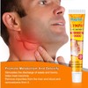 Lymph Nodes Herbal Detox Cream, Lymphatic Care Ointment, Lymphatic Drainage